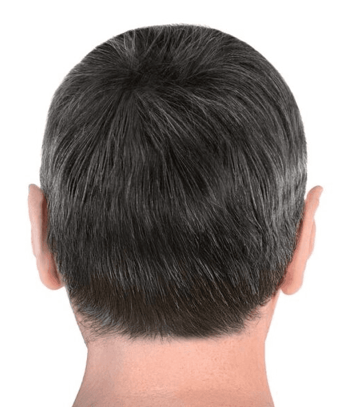 After treatment